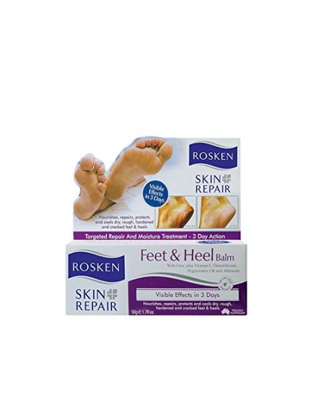 Rosken Feet & Heel Balm 50gm